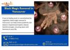 Break Free with Black Magic Removal in Vancouver