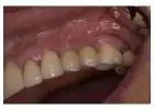 Biological Dentist in Tijuana, Mexico – Safe, Natural Dental Care