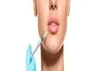 Best treatment for Lip Fillers in Maitland