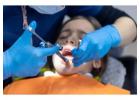 Emergency Dentist in Allentown – Fast Relief for Dental Pain | Aspire Dental Studio