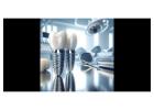 Siiodent Implants: Advancing Dental Implant Research and Development