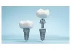 Siiodent Implants: High-Quality Basal SH Implants You Trust