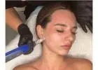 Skin Needling For Wrinkles