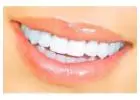 Orthodontic treatment in Dubai