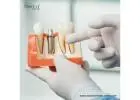 Best Dental Implants Brands in Paraguay for Quality & Value
