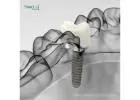 Explore Reliable OEM Partners in Mexico for Dental Solutions