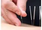 Midtown Acupuncture