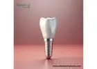 Dental Implant Suppliers For Mexico Serving Your Needs