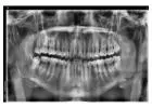 Holistic Dentist in Mexico – Natural, Biocompatible Care for Your Health and Smile