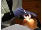 Smile Makeovers at Dental Clinic Collingwood