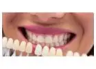 Best Dental Clinic in Abu Dhabi