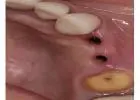Holistic Dentist in Mexico – Natural, Biocompatible Care for Your Health and Smile