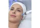 Best Skin Needling service in Wannanup