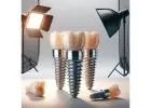 Durable HRI Straight Hex Abutment You Can Trust