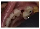 Holistic Dentist in Mexico – Natural, Biocompatible Care for Your Health and Smile