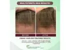 Reclaim Confidence with Natural Solutions for Thinning Hair