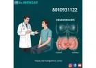 Top piles doctor in Rajghat Power house