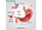 Lady doctor for stomach pain in Ghazipur