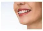 Affordable Braces Treatment in Paldi, Ahmedabad – Book Now!