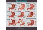 Stomach related doctor in Sonia Vihar
