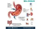 Best gastroenterologists in Delhi