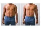 Liposuction for Quick Fat Reduction in Islamabad