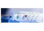 Flexible Dental Payment Plan – Affordable Care for Everyone