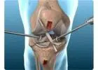Top Knee Replacement Surgeon in Vaishali Nagar Jaipur – Dr. Arvind Asopa