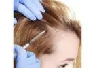 PRP Hair Treatment in Islamabad
