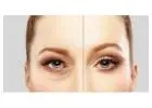 Eyelid Surgery in Islamabad