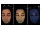 DermaQuip Esthetician Skin Analysis with Advanced PEAR 3D Imaging for Professional Skincare Diagnos