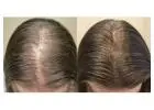 Natural Hair Regrowth Methods to Regrow Hair Naturally