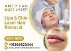 Lip & Chin Laser Hair Removal Austin, Texas – Professional & Effective Facial Hair Removal