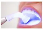 Get a Confident Smile with Teeth Whitening Melbourne Now