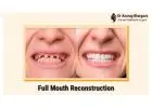 Teeth Reconstruction for a Confident Smile | Dr. Anurag Bhargava
