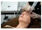 CO2 Laser Resurfacing Altamonte Springs