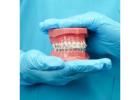 Straighten Your Teeth with Braces Treatment in