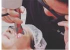 Non-Surgical Facelift & Acne Scar Treatment Singapore