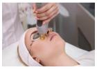 Fractionated CO2 Laser for Acne Scars & Pigmentation in Altamonte Springs